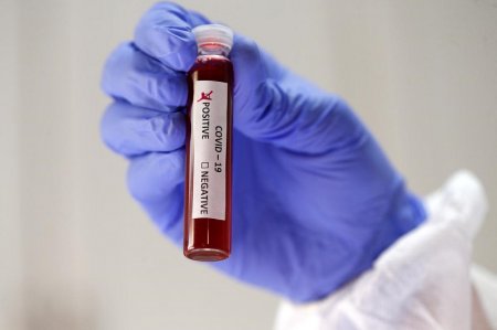 Қызылордада өткен тәулікте 75 адамнан коронавирус анықталды