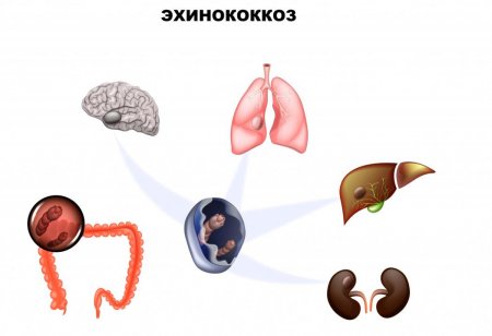 Туберкулез дегеніміз не?