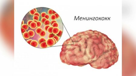 Менингококк инфекциясының алдын алу